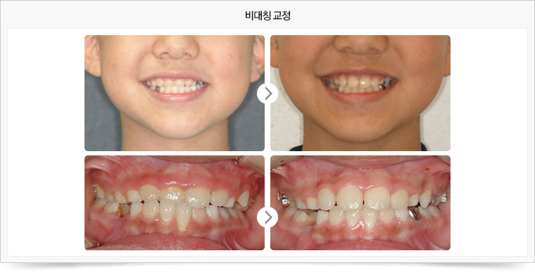 치료전후