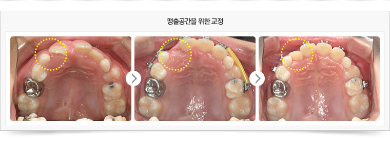 치료전후